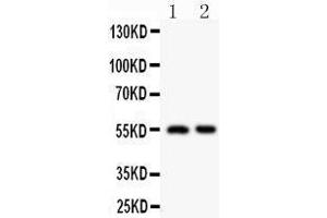 Anti-HDAC2 antibody,  Western blotting All lanes: Anti HDAC2 () at 0. (HDAC2 抗体  (C-Term))