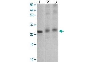 The tissue/cell lysate derived from mouse liver (Lane 1), mouse muscle (Lane 2) and MCF-7 (Lane 3) were immunoprobed by SOCS1 polyclonal antibody  at 1 : 500. (SOCS1 抗体  (C-Term))