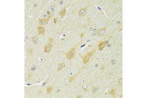 Immunohistochemistry of paraffin-embedded rat brain using SLC25A1 antibody.