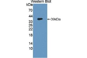 Detection of Recombinant GCPII, Human using Polyclonal Antibody to Prostate-specific Membrane Antigen (PMSA) (PSMA 抗体  (AA 274-587))