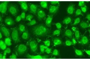 Immunofluorescence analysis of A549 cells using TSEN2 Polyclonal Antibody (TSEN2 抗体)