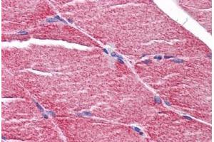 Human Skeletal Muscle: Formalin-Fixed, Paraffin-Embedded (FFPE) (MYBPC2 抗体  (C-Term))