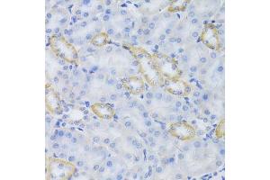 Immunohistochemistry of paraffin-embedded mouse kidney using MRPS30 Antibody. (MRPS30 抗体  (AA 190-439))