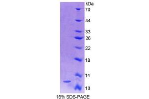 Image no. 1 for S100 Calcium Binding Protein A4 (S100A4) (AA 2-101) protein (His tag) (ABIN1080721) (s100a4 Protein (AA 2-101) (His tag))