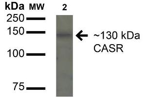 Western blot analysis of Rat Kidney cell lysates showing detection of 130kDa Calcium Sensing Receptor protein using Rabbit Anti-Calcium Sensing Receptor Polyclonal Antibody . (CASR 抗体  (AA 1-100) (HRP))
