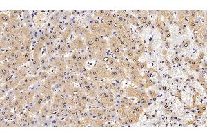 Immunohistochemistry (IHC) image for anti-Mitogen-Activated Protein Kinase 1 (MAPK1) (AA 25-360) antibody (ABIN7445753)