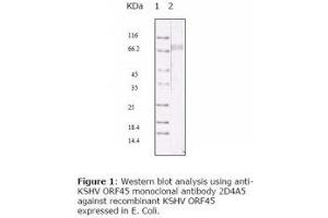 Image no. 1 for anti-HHV-8 ORF45 antibody (ABIN478369) (HHV-8 ORF45 抗体)