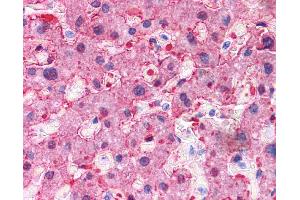 Immunohistochemistry (IHC) image for anti-Arginase, Liver (ARG1) (N-Term) antibody (ABIN2782309) (Liver Arginase 抗体  (N-Term))
