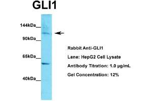 WB Suggested Anti-GLI1  Antibody Titration: 1. (GLI1 抗体  (C-Term))