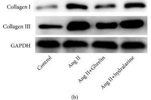Ghrelin lowered systolic blood pressure and collagen I and collagen III protein expression in the myocardium of Ang II-infused rats. (GAPDH 抗体  (AA 1-335))