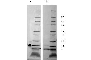 SDS-PAGE of Mouse Stromal Cell-Derived Factor-1 alpha (CXCL12) Recombinant Protein SDS-PAGE of Mouse Stromal Cell-Derived Factor-1 alpha (CXCL12) Recombinant Protein. (CXCL12 蛋白)