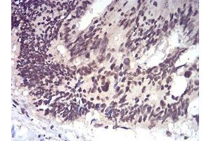 Immunohistochemistry (IHC) image for anti-RAD50 Homolog (S. Cerevisiae) (RAD50) (AA 228-359) antibody (ABIN5542671)