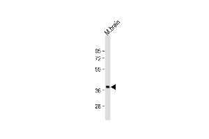 Anti-RASSF2 Antibody (N-Term)at 1:2000 dilution + mouse brain lysates Lysates/proteins at 20 μg per lane. (RASSF2 抗体  (AA 64-98))