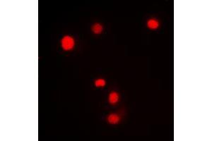 Immunofluorescent analysis of SP1 (pT453) staining in Jurkat cells.
