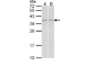 WB Image Sample (30 ug of whole cell lysate) A: A431 , B: Hela 12% SDS PAGE antibody diluted at 1:1000 (TGIF2 抗体  (C-Term))