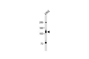 All lanes : Anti-ROR2 Antibody (N-term) at 1:1000 dilution + K562 whole cell lysate Lysates/proteins at 20 μg per lane.