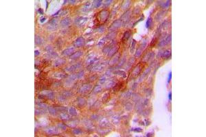 Immunohistochemistry (IHC) image for anti-Chorionic Gonadotropin, beta Polypeptide (CGB) (C-Term) antibody (ABIN7295256)