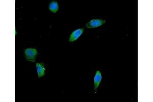 IF analysis of AES using anti-AES antibody (ABIN6719264).