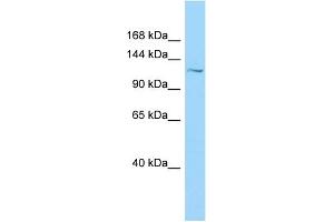 WB Suggested Anti-PKD1L1 Antibody Titration: 1. (PKD1L1 抗体  (N-Term))