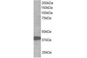 Image no. 1 for anti-Ring Finger Protein 39 (RNF39) (C-Term) antibody (ABIN374298) (RNF39 抗体  (C-Term))