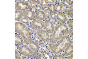 Immunohistochemistry of paraffin-embedded mouse kidney using NLRC4 antibody at dilution of 1:100 (x400 lens). (NLRC4 抗体)