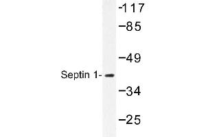 Image no. 1 for anti-Septin 1 (SEPT1) antibody (ABIN272245) (Septin 1 抗体)