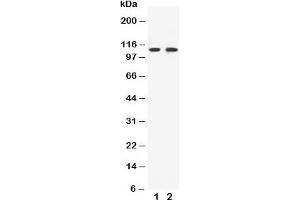 Western blot testing of EphB3 antibody and Lane 1:  HeLa;  2: A549 cell lysate (EPH Receptor B3 抗体  (C-Term))