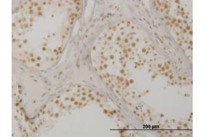Image no. 1 for anti-Oxidative-Stress Responsive 1 (OXSR1) (AA 351-450) antibody (ABIN599103) (OXSR1 抗体  (AA 351-450))