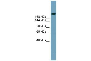 WB Suggested Anti-ABCA12 Antibody Titration:  0. (ABCA12 抗体  (Middle Region))