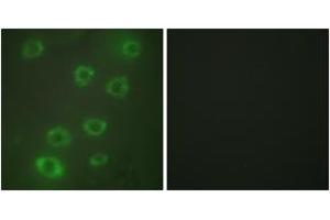 Immunofluorescence analysis of HuvEc cells, using PTX3 Antibody. (PTX3 抗体  (AA 1-50))
