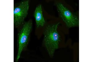 IF analysis of RRP1 and Tubulin beta using anti-RRP1 antibody (ABIN7600683) and anti-Tubulin beta antibody (ABIN7602744). (RRP1 抗体  (AA 22-237))