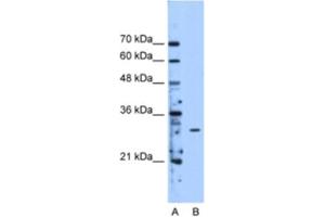 Western Blotting (WB) image for anti-Methyltransferase Like 1 (METTL1) antibody (ABIN2463199) (METTL1 抗体)