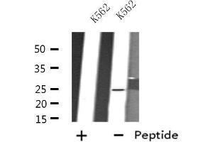 Western blot analysis of extracts from K562 cells, using FEV antibody. (FEV 抗体  (N-Term))