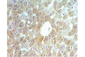 Rat liver tissue was stained by rabbit Anti-ABCB6 (260-301) (Human, Mouse ) Serum (ENPP2 抗体  (AA 369-391))