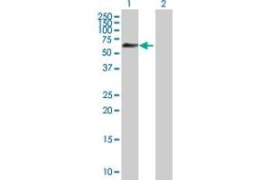 Western Blot analysis of ZNF446 expression in transfected 293T cell line by ZNF446 MaxPab polyclonal antibody. (ZNF446 抗体  (AA 1-450))