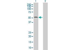 Western Blotting (WB) image for CAMK2A 293T Cell Transient Overexpression Lysate(Denatured) (ABIN1331162)