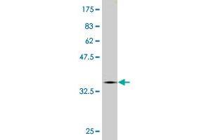 Western Blot detection against Immunogen (36. (CNOT2 抗体  (AA 441-540))