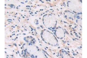 Immunohistochemistry (IHC) image for anti-Cat Eye Syndrome Chromosome Region, Candidate 1 (CECR1) (AA 30-511) antibody (ABIN7430045)