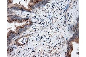 Immunohistochemical staining of paraffin-embedded Kidney tissue using anti-LIPG mouse monoclonal antibody. (LIPG 抗体)