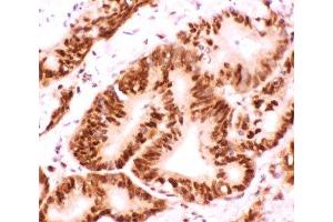 Immunohistochemistry (IHC) image for anti-Activating Transcription Factor 2 (ATF2) (AA 93-450) antibody (ABIN3029845)