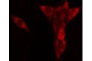 ABIN6268950 staining HeLa? (Dematin 抗体  (C-Term))
