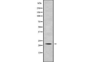 Western Blotting (WB) image for anti-Potassium Large Conductance Calcium-Activated Channel, Subfamily M, beta Member 1 (KCNMB1) antibody (ABIN6262754)