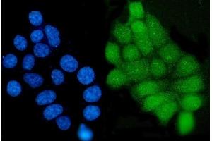 IF analysis of Grainyhead-like protein 1/GRHL1 using anti-Grainyhead-like protein 1/GRHL1 antibody (ABIN7599498).