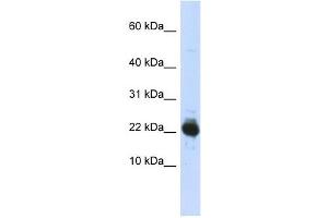 UBE2L3 antibody used at 1 ug/ml to detect target protein. (UBE2L3 抗体  (Middle Region))