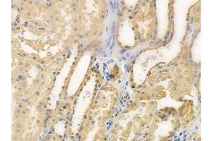 ABIN6258339 and ABIN6275792 at 1/100 staining human normal kidney tissue by IHC-P. (TRAF4 抗体  (Internal Region))