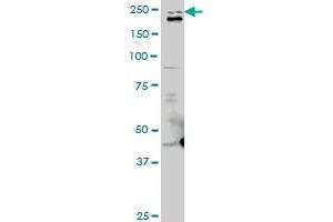 TLN1 monoclonal antibody (M06), clone 2E10. (TLN1 抗体  (AA 1052-1149))