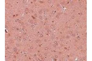 Immunohistochemistry (IHC) image for anti-Golgi Membrane Protein 1 (GOLM1) (Middle Region) antibody (ABIN1030941) (GOLM1 抗体  (Middle Region))