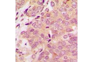 Immunohistochemistry (IHC) image for anti-S100 Calcium Binding Protein A11 (S100A11) antibody (ABIN7308300) (S100A11 抗体)