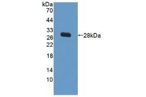 Detection of Recombinant VCAM1, Human using Polyclonal Antibody to Vascular Cell Adhesion Molecule 1 (VCAM1)