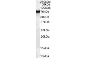 Western Blotting (WB) image for anti-Frizzled Family Receptor 8 (FZD8) (AA 684-694) antibody (ABIN297075) (FZD8 抗体  (AA 684-694))